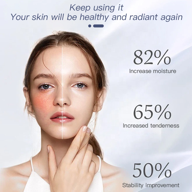 Private Label Organic Daily Moisturizer Intense Hydration Face Lotion Skin Care Moisturizing Face Cream