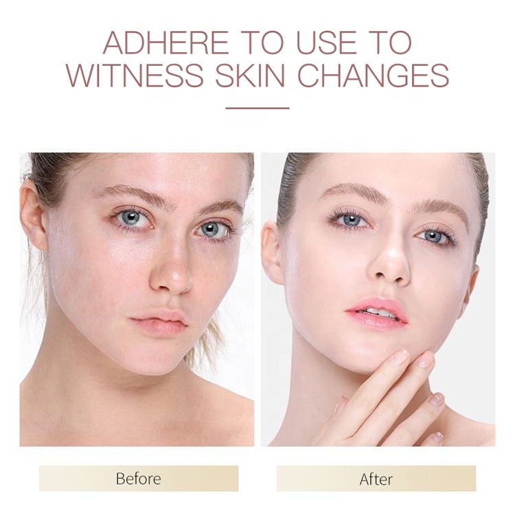 Oem Private Label Natural Organic Rose Water Facial Mist Hydrating Skin Care Face Toner Rose Water For Face
