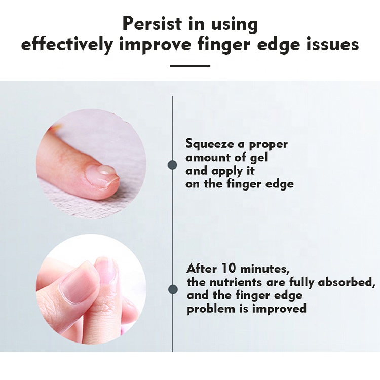 Wholesale Cuticle Softener Remover Liquid Nail Gel Private Label Cuticle Remover Solution Treatment