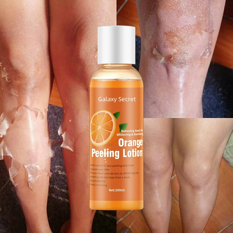 Orange Peel Body Lotion With Whitening Features Cream Form Vitamin C Oem Supply Mild Exfoliating Gel Peel Body Lotion