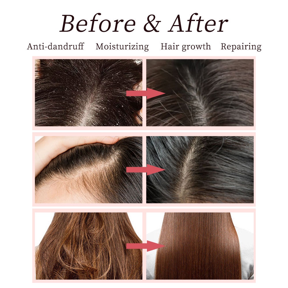 Private Label Keratin Argan Oil Rosemary Collagen Vitamin B5 Anti-loss Biotin Shampoo Conditioner Sulfate-free Hair Regrowth Gel
