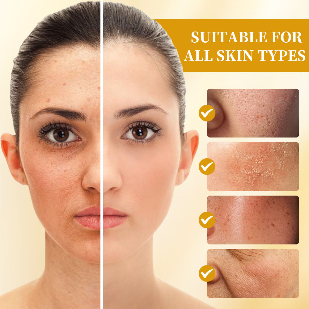 Oem Customize Label Whitening Serum Corrector For Freckles Melasma Dark Spots Removes Melanin Pigmentation And Brightens Skin