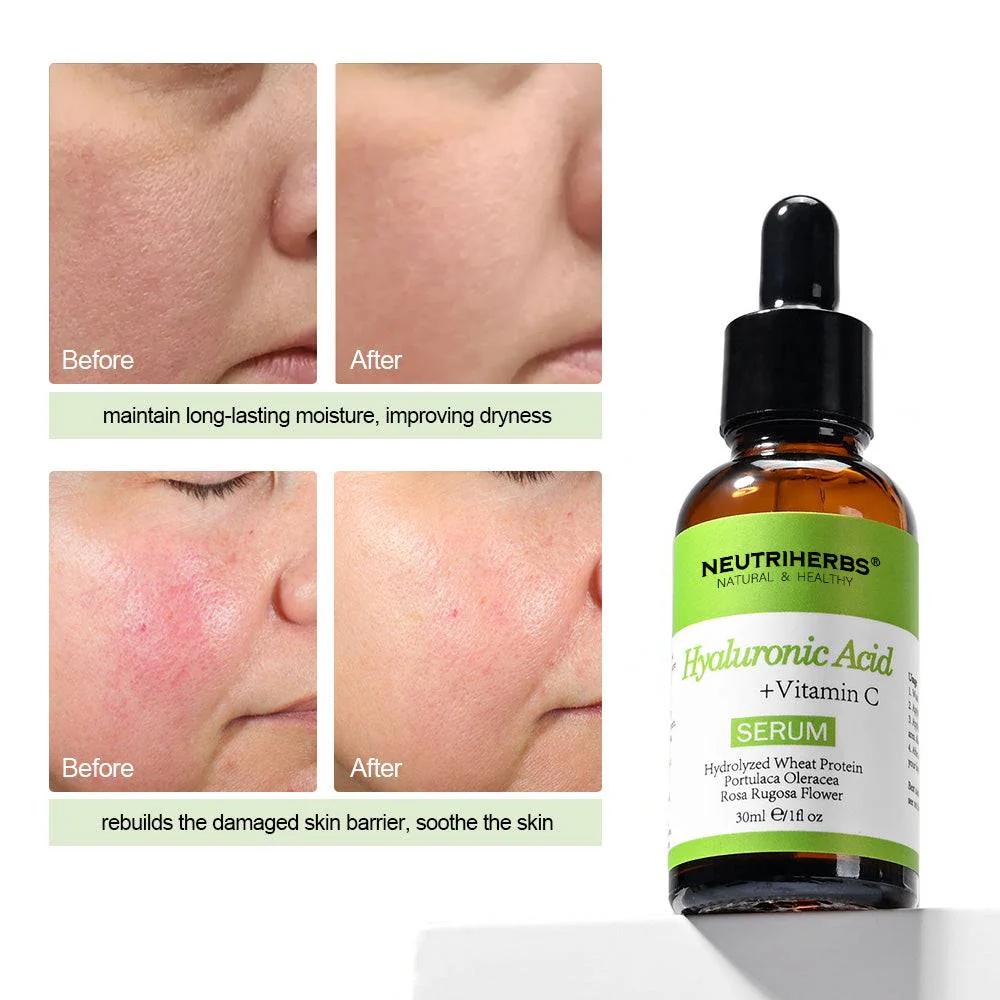 Oem Private Label Best Hyaluronic Acid Thirst Quenching Anti-aging Vegan Face Serum For All Skin Types Plumps & Hydrates