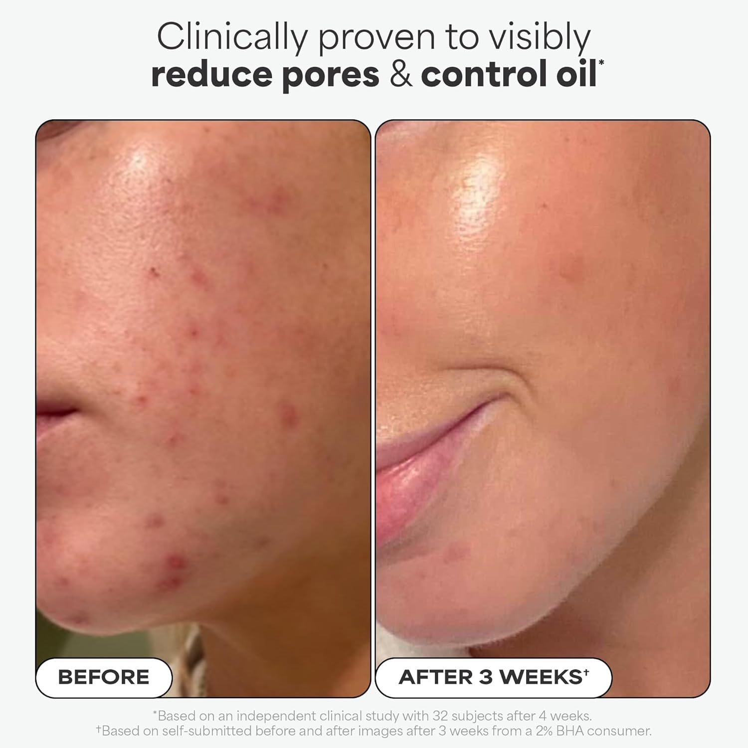 Oem/odm Private Label Salicylic Acid Serum Camellia Sinensis Leaf Extract Serum 2% Bha Liquid Exfoliant Salicylic Acid