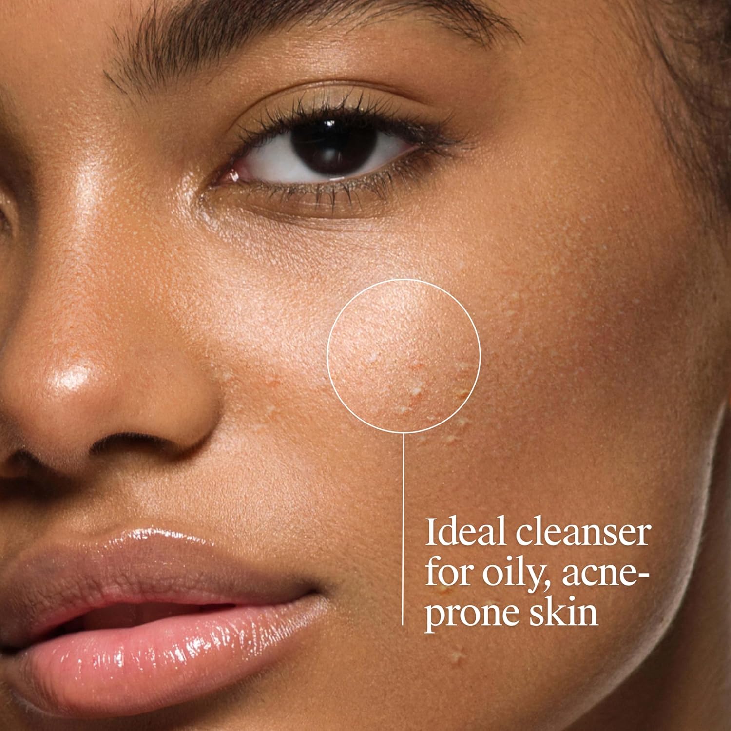 Oem/odm Private Label Oil-free Acne Wash Cleanser Pump Salicylic Acid Acne Treatm Moisturizing Skin For Face