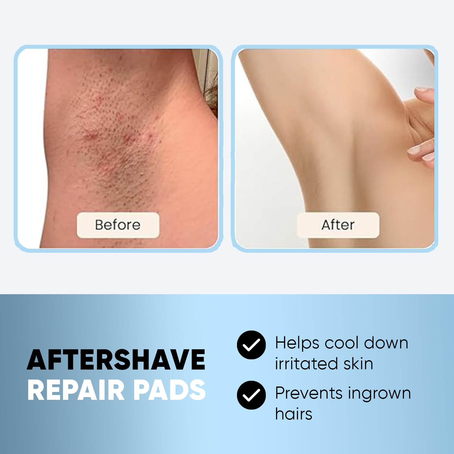 Private Label Best Quality Salicylic Acid Ingrown Hair Exfoliating Pads Safety And Gentle Bump Eliminating Peeling Pads